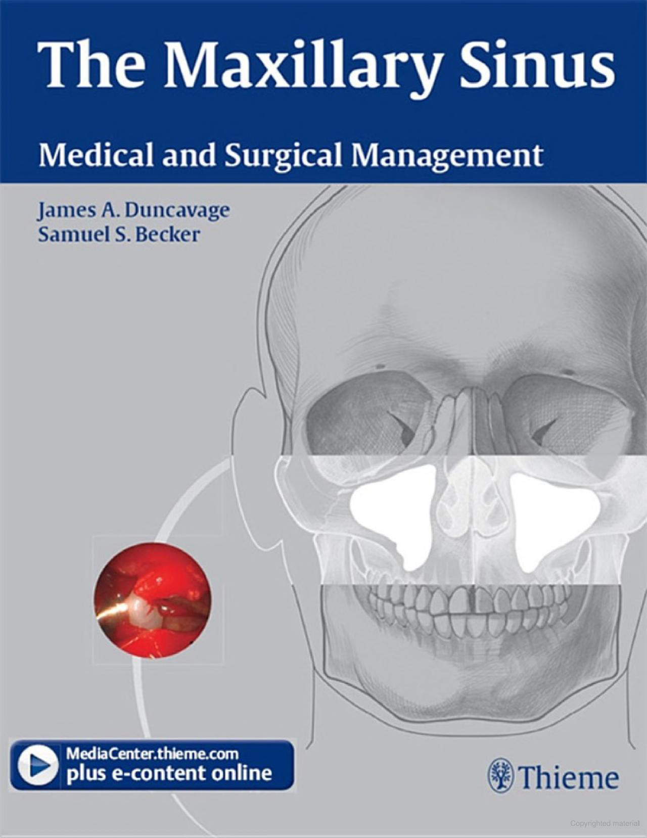 maxillary-sinus